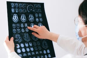 Una neuróloga reveló cómo cuidar el cerebro a través de la alimentación