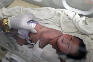 La "beba milagro" que nació bajo los escombros fue adoptada por sus tíos