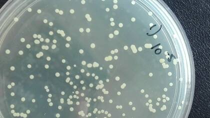 Una placa de Petri con una colonia de Brevibacterium linens