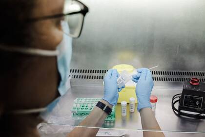 Una profesional de laboratorio sostiene una de las pruebas de análisis para la viruela del mono, en el Hospital Ramón y Cajal, a 30 de mayo de 2022, en Madrid (España). Europa Press.