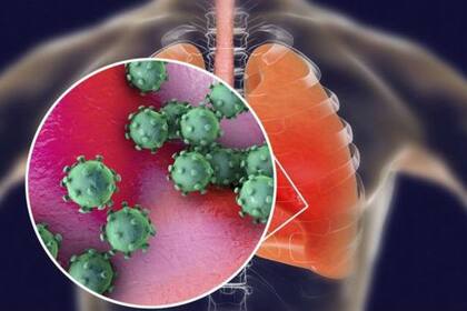 Uno de los efectos del nuevo coronavirus es la inflamación de los pulmones