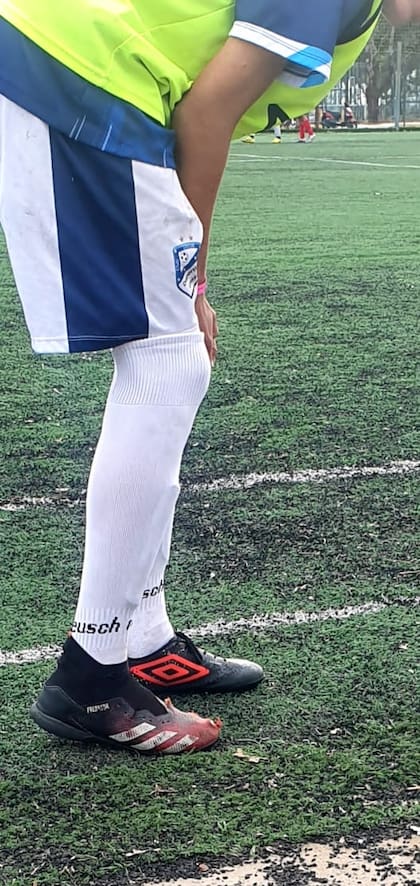 Uno de los jugadores de Club Social Deportivo Unión jugó la final con botines diferentes