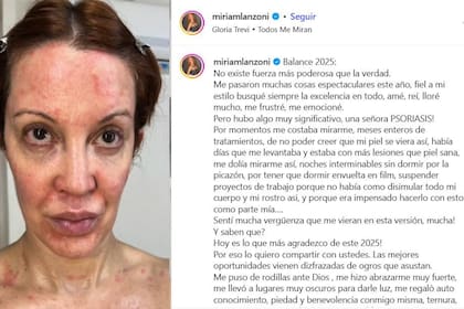 Uno de los posteos en donde Miriam Lanzoni se sinceró sobre lo que vivió en 2025