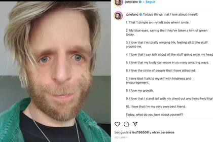 Uno de los tantos posteos de Jono Lancaster, hoy al frente de su propia fundación: Love Me Love My Face