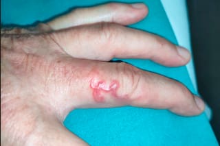 El parásito intestinal de perros y gatos que, “por error”, también corre bajo la piel del ser humano