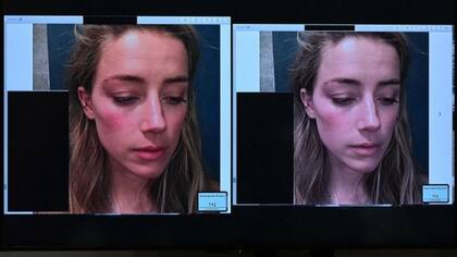 Vásquez sugirió que la foto de la izquierda había sido retocada para que el pómulo de Heard se viera más rojizo