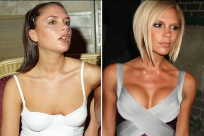 Victoria Beckham itió que en los noventa tenía implantes mamarios que luego se quitó