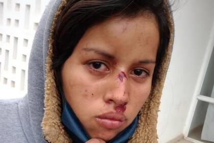 Violencia policial y discriminación en Chaco: miembros de las fuerzas de seguridad atacaron a una familia qom