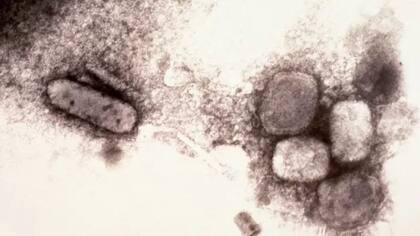 Visión microscópica del virus que causa la viruela.
