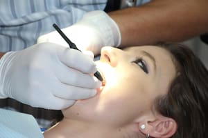 Visitar al dentista reduce en 81% el riesgo de enfermedad de las encías y caries combinadas (Foto de carácter ilustrativo: PIXABAY)