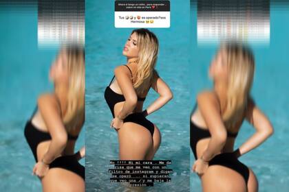 Wanda Nara confesó por qué no se realizó ninguna cirugía estética