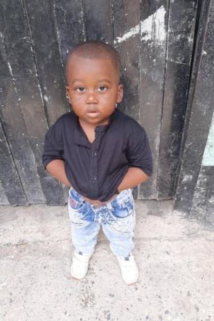 Yanfry padece de hipotiroidismo. Su estatura es la de un niño de año y medio de edad