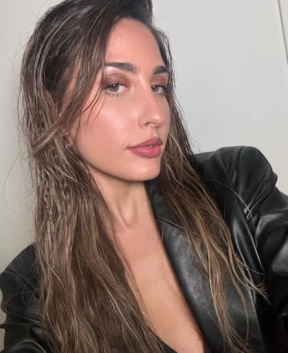 Yoyi Francella contó en Antes que nadie, el accidente doméstico que sufrió (Foto: Instagram @yoyifrancella)