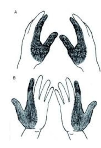 Zonas de influencia al disparar un arma de fuego