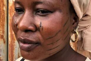 La violenta práctica a niños que es vista en África como símbolo de orgullo y belleza