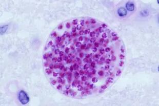 Quiste microscópico de Toxoplasma gondii desarrollado en el cerebro de un ratón