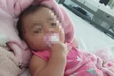 Una beba de cinco meses fue herida de una perdigonada durante un procedimiento policial