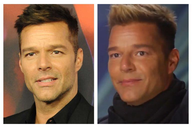 Ricky Martin reapareció en una entrevista con visibles cambios en su rostro