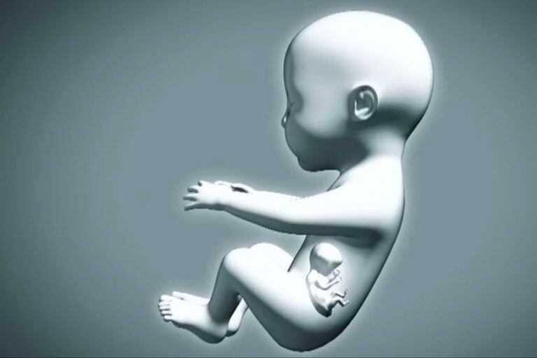 El fenómeno se conoce como fetus in fetu o gemelo parásito y ocurre una vez en un millón de casos (la imagen es ilustrativa)